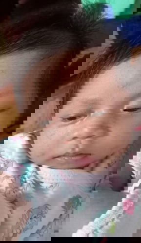 Ano po yung nasa mukha ni baby