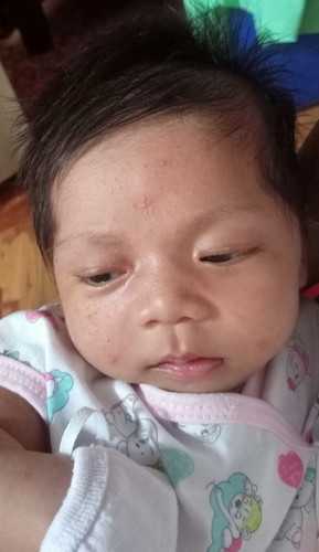 Ano po yung nasa mukha ni baby