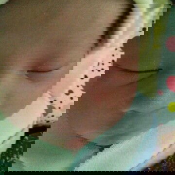 bintik" putih di hidung