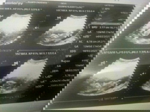 13mnggu udh klhtan besar