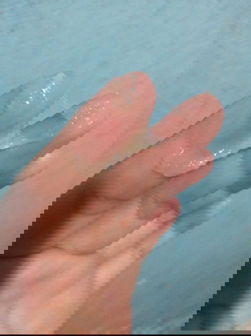 39+5วีคใช่มูกใสมั้ยค่ะ