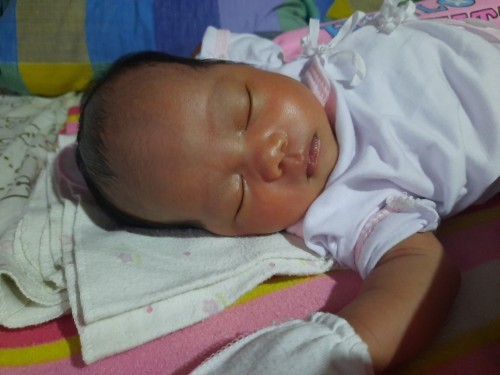 Baby's Head Shape!!