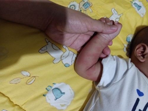 Rashes all over the body