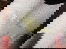 Mucus plug or Discharge?