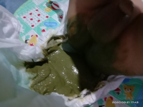 Poop ni Baby....