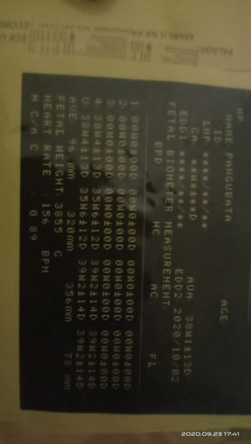 ilan napo kaya kilo nung baby ko ?