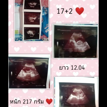 กำหนดคลอดกุมภาพันธ์