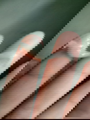 สอบถามคะ 36+1วีค