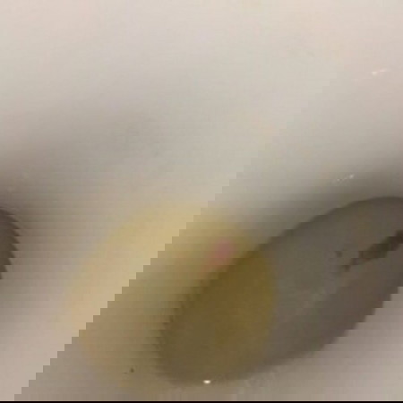 ควรไปหาหมอดีไหม