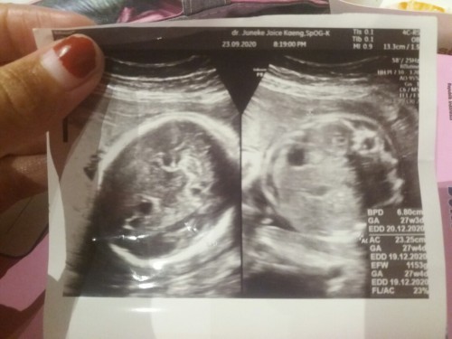 Baby boy❤