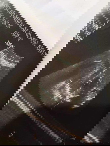 Baby’s Gender?