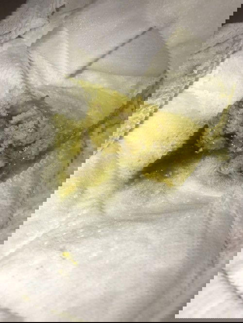 น้องอึเป็นมูกแบบนี้ปกติมั้ยคะ