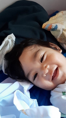 Gilagid sa gitna ng dalawang ngipin sa taas