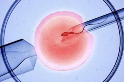 Successfully IVF