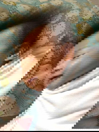 Babies head shape