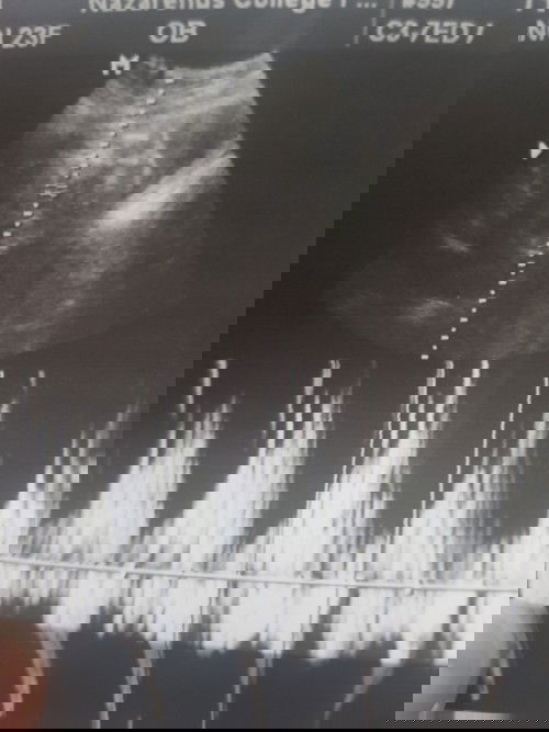 ultra question - can anyone explain?