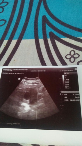 Kehamilan saya baru 7minggu,di usg katanya ada kantung bayi saja isi nya kosong..