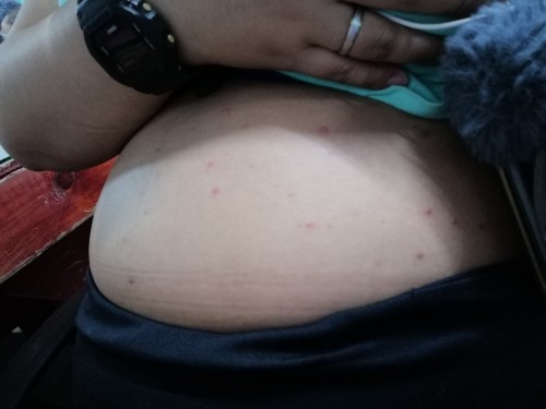 Pa help po kung normal lang ba ito sa buntis.