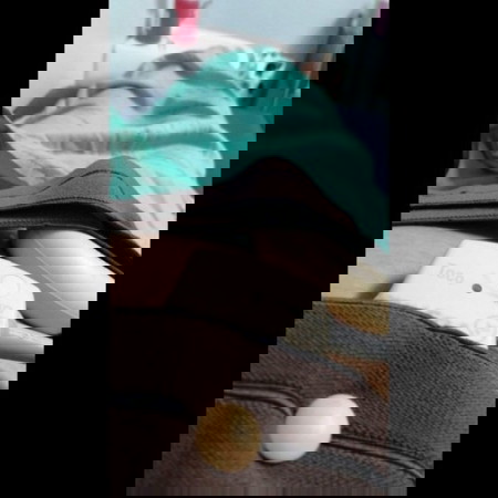 ท้องปั้นบ่อย