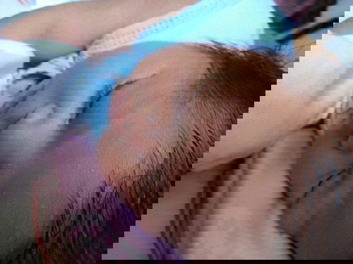 Ano to? 😣 ang mga nasa mukha ng anak ko