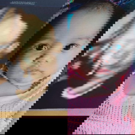 ตอนซาวด์มีคนทักว่าลูกปากแหว่ง