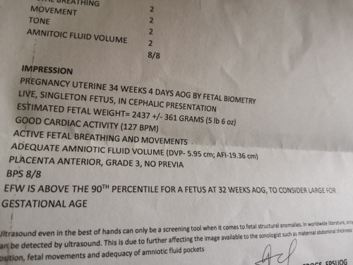Large gestational age