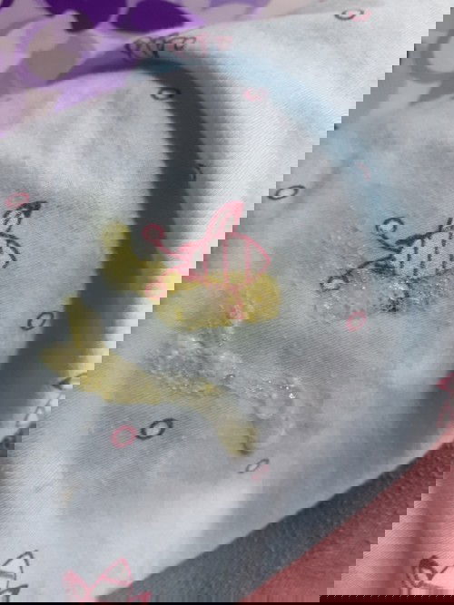 Dạ cho e hỏi bé nhà thở khó khè rồi ói ra như này có sao hok