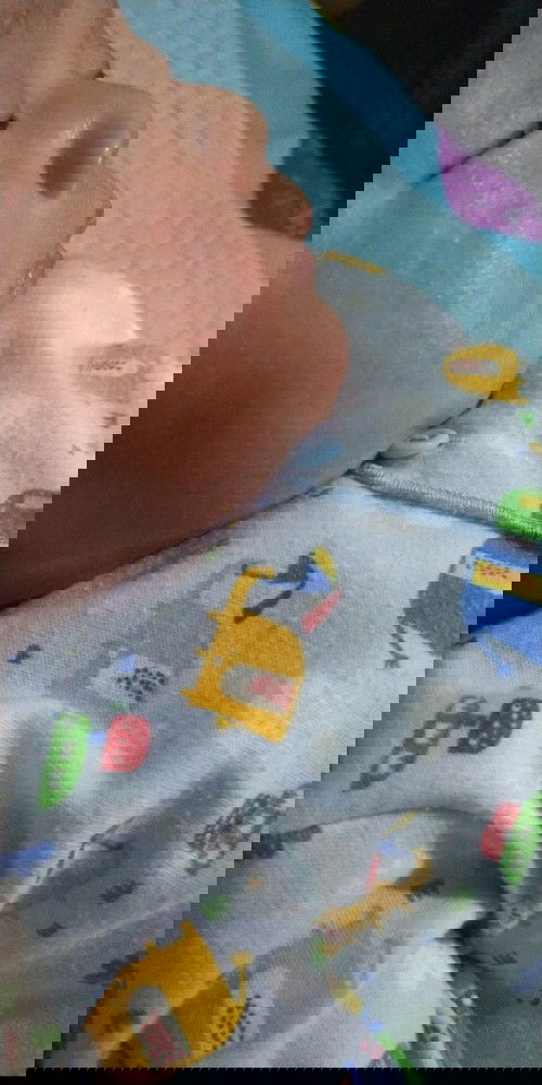 Pipi anak saya merah kanan kiri sudah 1 minggu bantu solusi bunda bunda