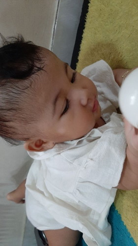 Rambut tumbuh tidak rata.