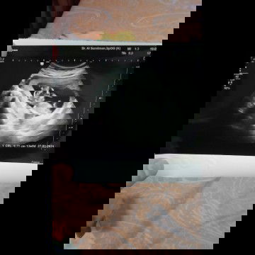 kluar gumpalan darah