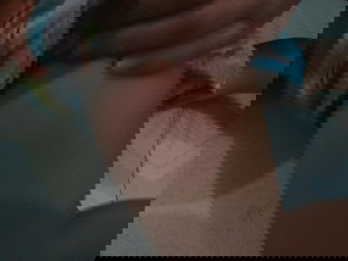 Bekas Suntikan 1tahun 6bulan