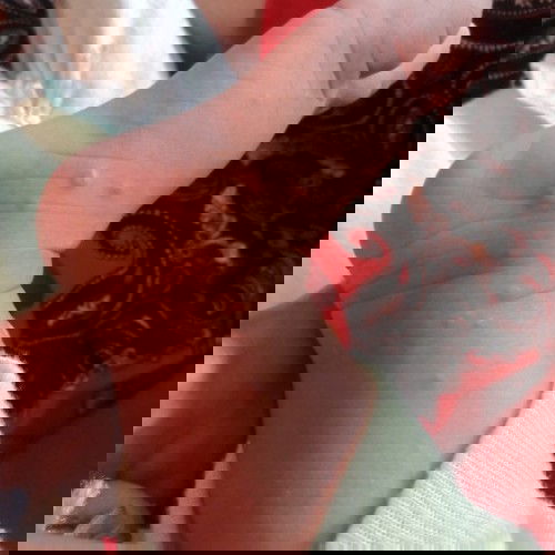 Obat cacar air anak usia 3 bulan