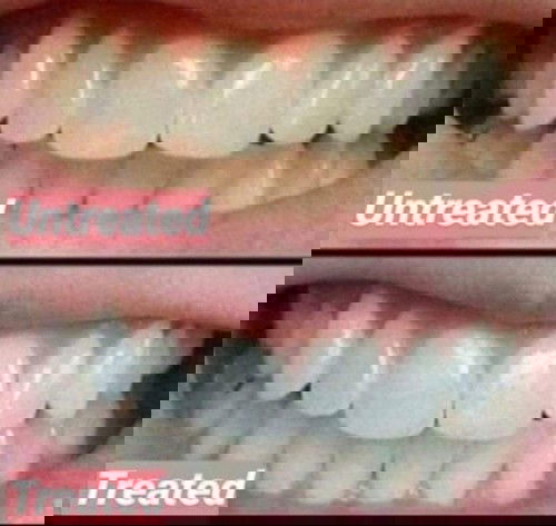 Hi friends! 😊

Share ko lang ang ginagamit ng mga friends ko. Nakita ko talaga sa ibang friends