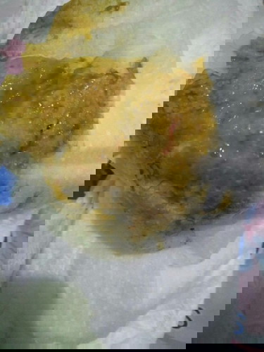 มูกเลือดในอุจจาระ