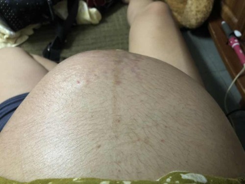 แยกไม่ออกระหว่างท้องปั้นกับน้องโก่งตัว