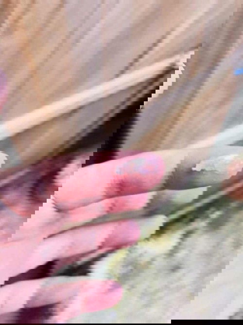 ตั้งครรภ์32week