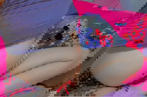 ประสบการณ์ผ่าคลอดท้อง2