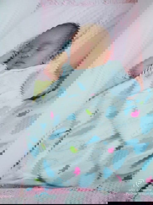 oligohydramnios + CS