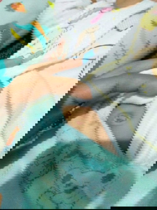 Bun ada yg sama ga kayak puser anak saya?