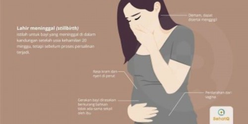 Still birth (lahir mati)