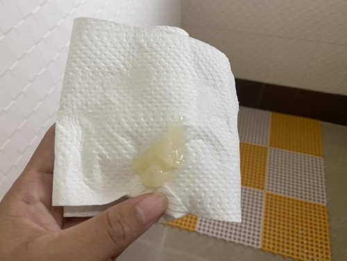 แบบนี้เรียกว่า มูก หรือ อะไรคะ