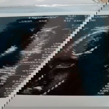 hpl bidan 29 september, hpl usg bulan oktober