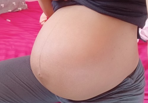 36Week มีน้ำใสๆออกจากช่องคลอด