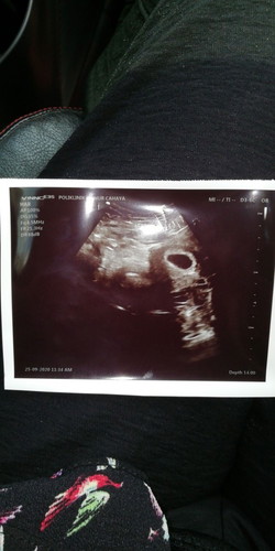 First Baby