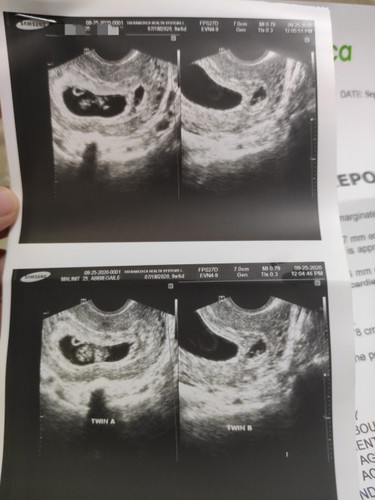 TWINS 8wks & 5 wks