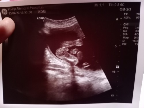 แบบนี้คือ ชายหรือหญิงคะ?!!