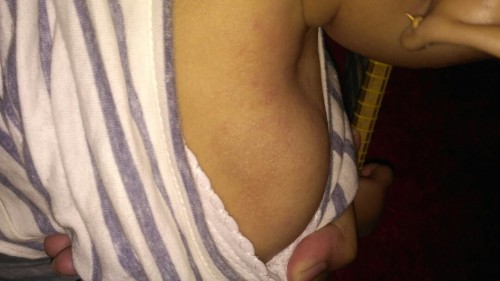 kulit bayi kering menghitam