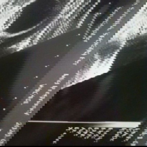 posisi bayi terlentang di bawah perut