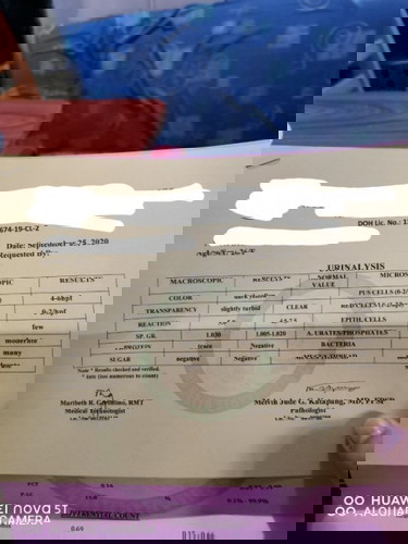 May UTI Nanaman Ba Ako?
