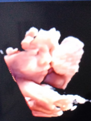 3พ.ย. ได้ผช.จ้า